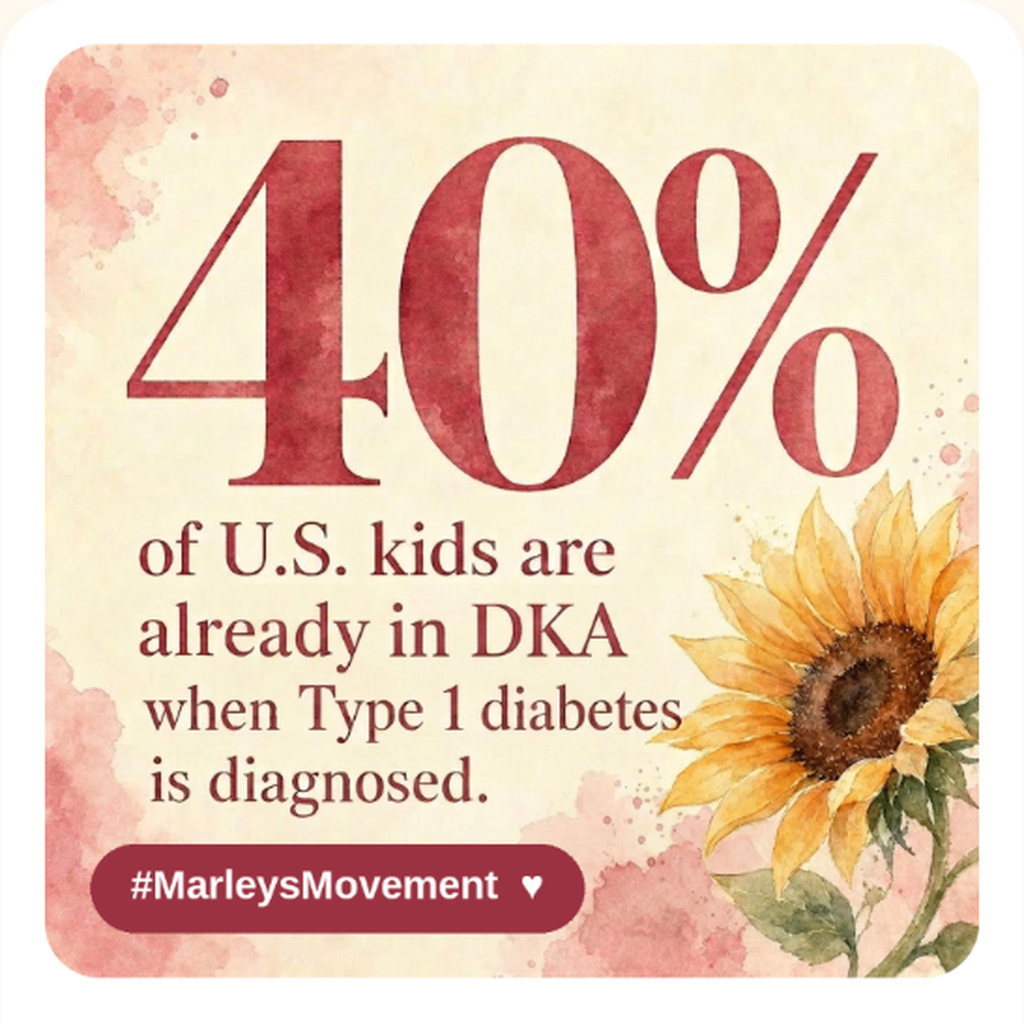 40% are in DKA at diagnosis